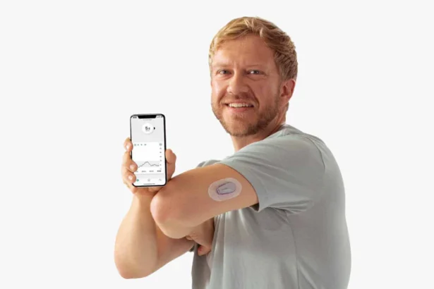 Dexcom